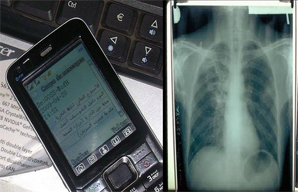 <!--:pt-->Com baixo custo, nova tecnologia promete melhorar controle da tuberculose<!--:--><!--:en-->A low cost, new technology promises to improve tu