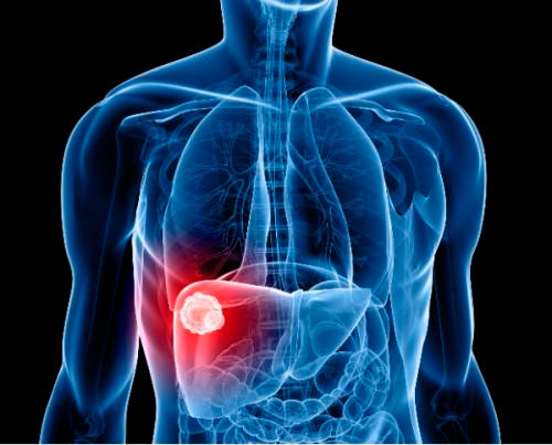 Manual técnico para o Diagnóstico das Hepatites Virais em Adultos e Crianças