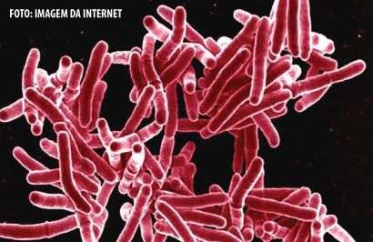 Newsletter 78 – Tuberculosis: We must join forces to face this global threat