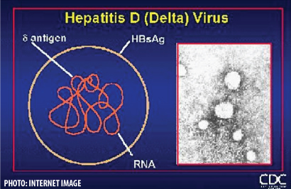 Newsletter  79 – Hepatitis Delta: The virus of the poor